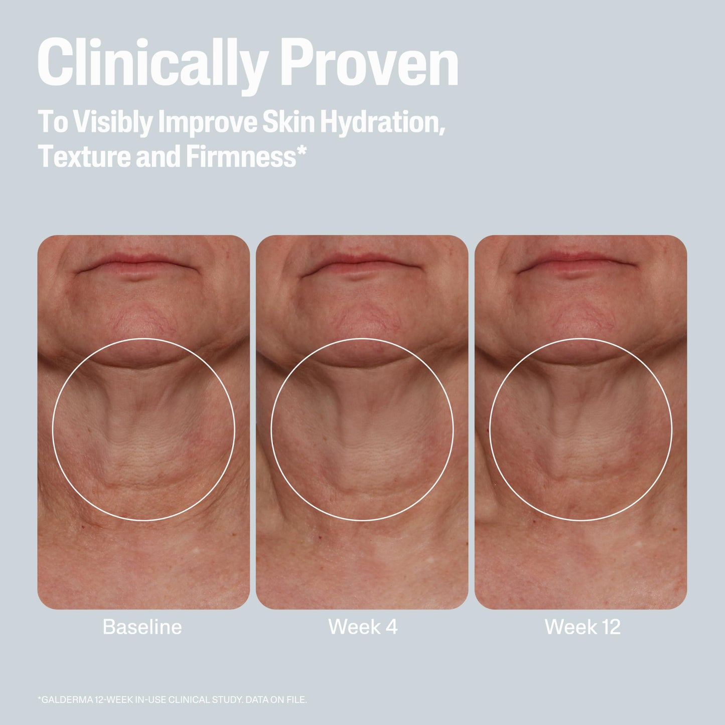 Cetaphil Skin Activator Hydrating & Firming Cream For Face, Neck & Chest 3.4 oz, Mandelic Acid (AHA) and Centella Asiatica (CICA) Cream, Hydrates and Firms Aging Skin, Anti-Aging Skincare